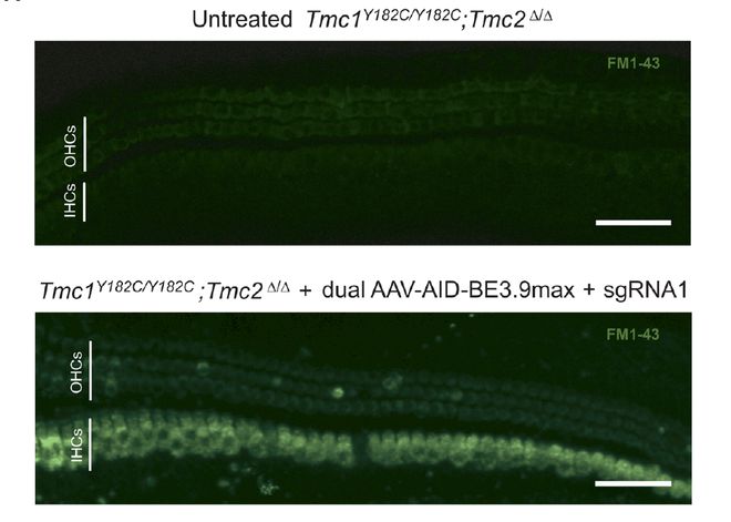 遺傳病治療重大突破：人類首次通過(guò)基因編輯攻克隱性遺傳病(圖3)