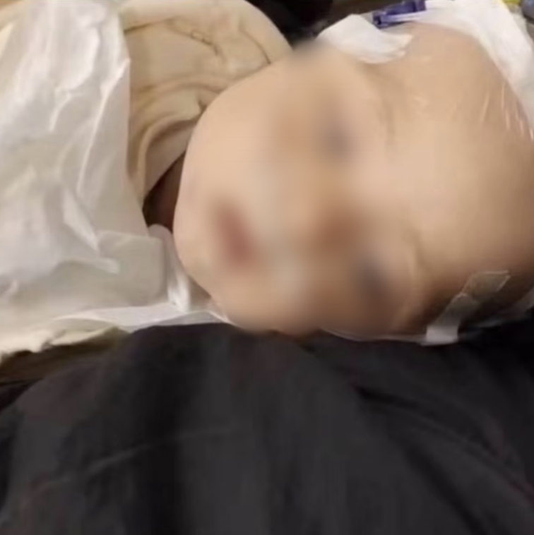 四川6月齡男嬰確診心衰、重癥肺炎：治療缺錢 母親發(fā)起求助(圖2)